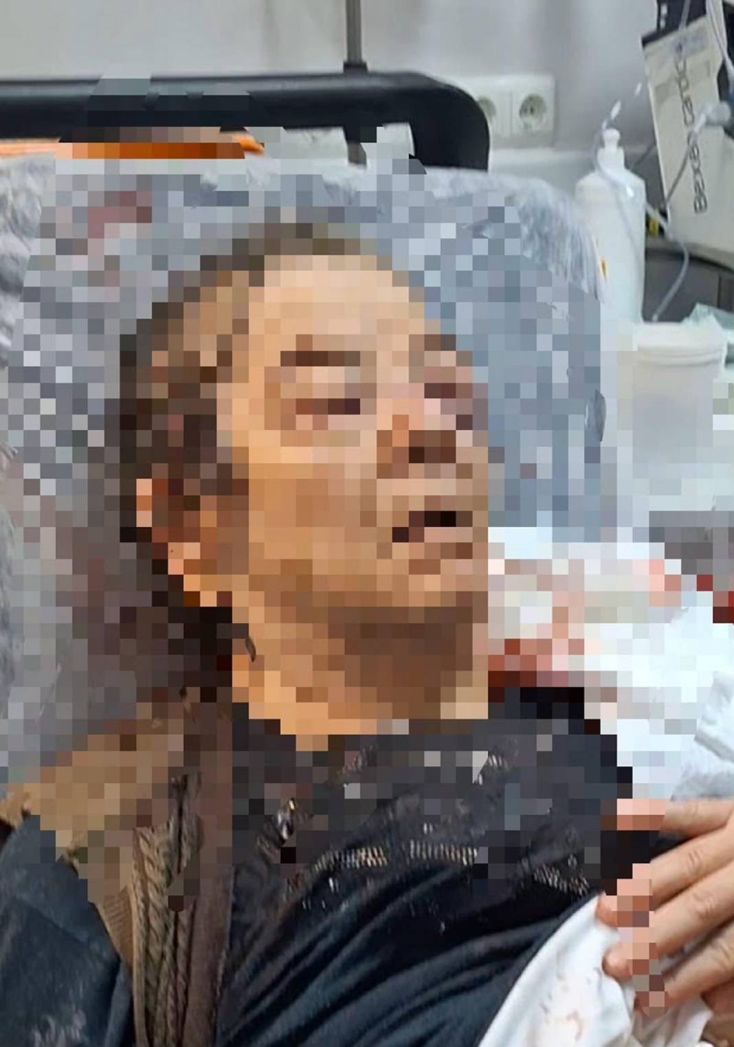 Evinde otururken kanlar içinde kaldı! 3